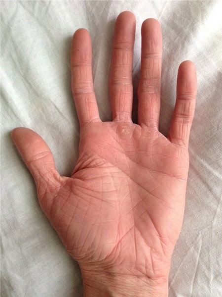 Значение промежутков между пальцами
